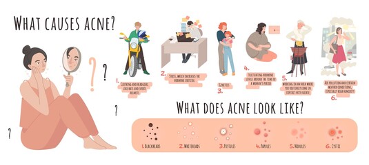 What causes acne. Landscape poster with useful information