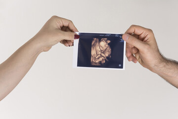 Parent's hands holding unborn baby sonography image isolated on white background