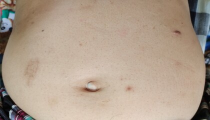  a man's belly sticking out.