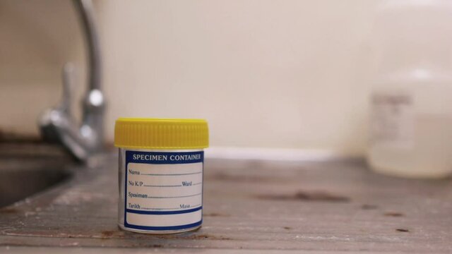 closeup clip of a urine or stool  specimen container 