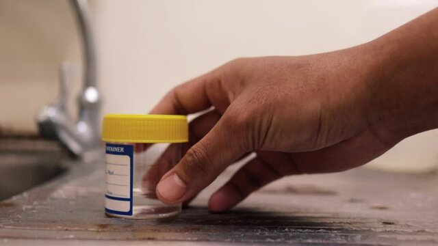 closeup clip of a urine or stool  specimen container 