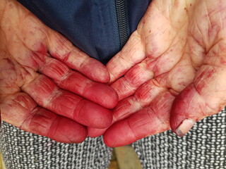 Blue hands after work