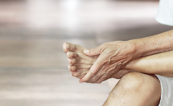 Close-up Of A Man's Arm Holding A Painful Foot Caused By Vaccination. Neurological Concept, Numb Hands And Feet