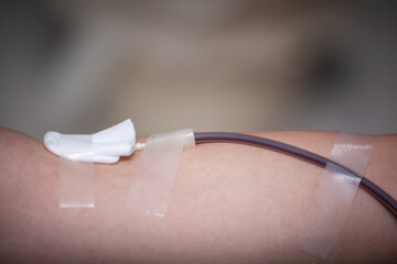 Arm of blood donator with needle.