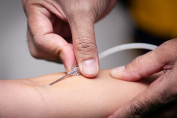 Arm of blood donator with needle.