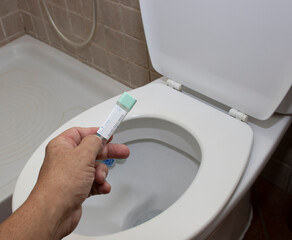 la revision a partir de los 50 años, de hacerse un test del cancer de colon es muy importante. La...