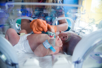 Noworodek w inkubatorze na oddziale neonatologii. Intensywna terapia.  - obrazy, fototapety, plakaty