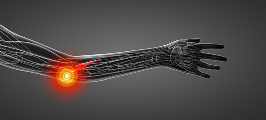 medical  illustration of the pronator teres