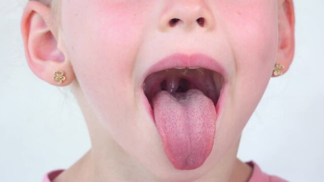 little girl show tongue, throat. child do gymnastics. kid Training of muscles speech therapy. Happy baby on white background. Place for text. portrait with wide open mouth and protruding tongue.