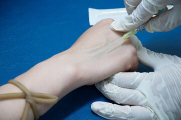 Close up of iv drip in patient's hand. Medical doctor provide intravenous fluid at the bed side in the hospital. medical treatment.