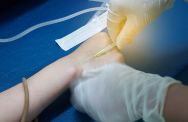 Close up of iv drip in patient's hand. Medical doctor provide intravenous fluid at the bed side in the hospital. medical treatment.