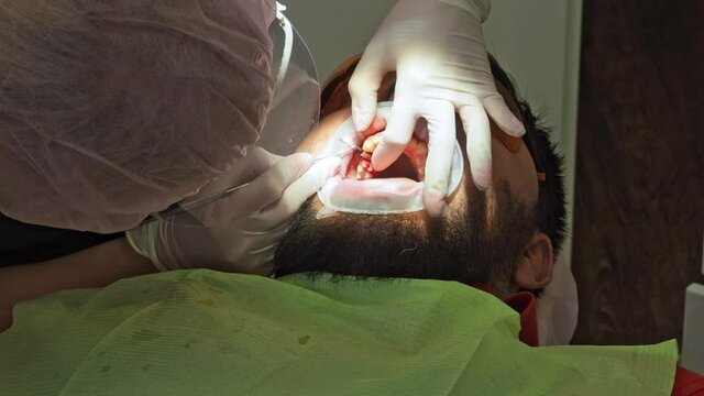 Latvia. Riga. 04.08.2019 Dentist In a Medical Gloves Works with a Patient Man in a Dental Office. Dentistry. Healthcare and Medicine Concept
