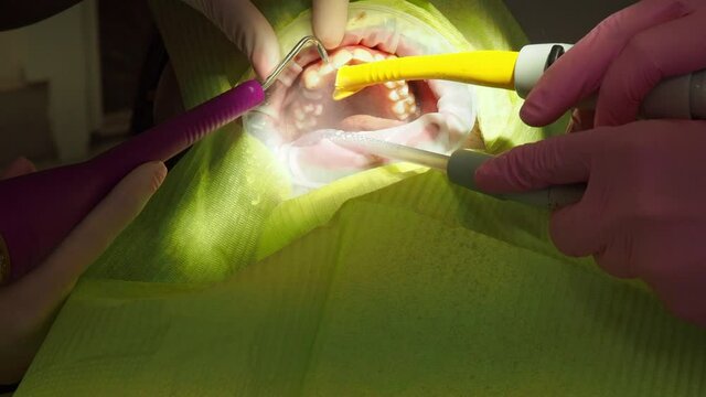 Latvia. Riga. 04.08.2019 Dentist In a Medical Gloves Works with a Patient Man in a Dental Office. Dentistry. Healthcare and Medicine Concept