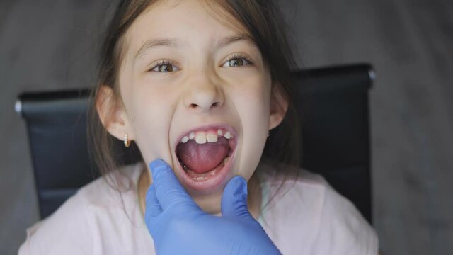 A pediatrician examines the open mouth of a child's girl, close-up.
