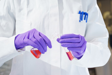 Researcher holds a flask with chemicals and reagents in his hands