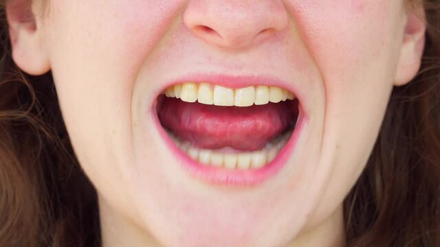 Adult fat girl smile and show tongue, throat. Happy woman close up. portrait with wide open mouth and protruding tongue. Show healthy yellow teeth to the dentist. Redhead girl with thin lips.