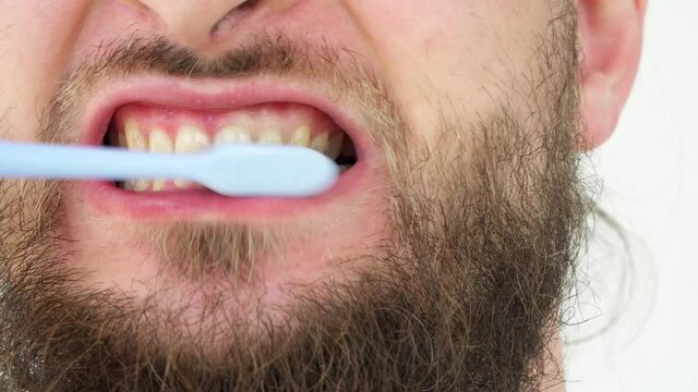 Brush adult teeth toothbrush. oral hygiene. need help dentist. Man with a beard mouth with yellow stained teeth Caucasian man. curved teeth of smoker covered with dental stone, close up. Tutorial
