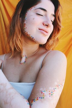 Happy smiling portrait of young woman with vitiligo on skin & colorful paint around spots and yellow background / body image, self love and celebration *2