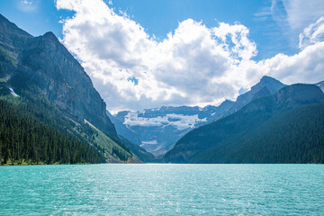 The glacial waters of Lake Louise bask in the bright sunlight, surrounded by the Canadian Rocky Mountains in Banff National Park, Alberta.