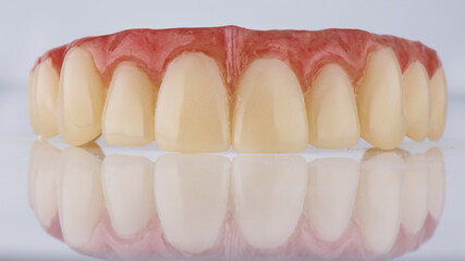 Dental prosthesis of the upper jaw temporary wearing with a pink gum, shot on a white background...