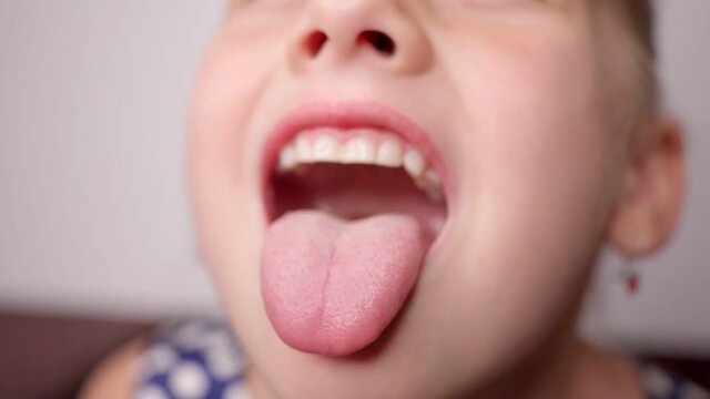 girl opens her mouth wide and pulls out long tongue. child shows his teeth and mouth to dentist. mouth is wide open, tongue is stuck out as far as possible, with clear view of tongue and soft palate