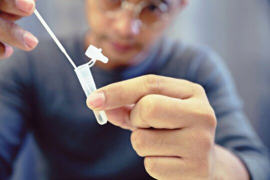 Man uses cotton swab to test for Covid-19 Insert a reagent bottle to look for what is believed to be a virus.