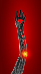 3d rendering medical  illustration of the palmaris longus