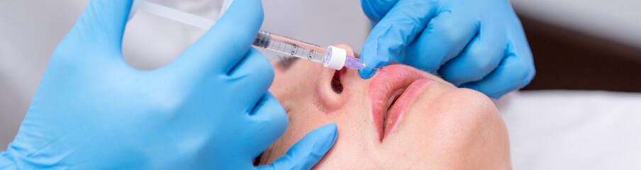 Lip augmentation. Beautician injects hyaluronic acid into the lips of a girl with a syringe. The...