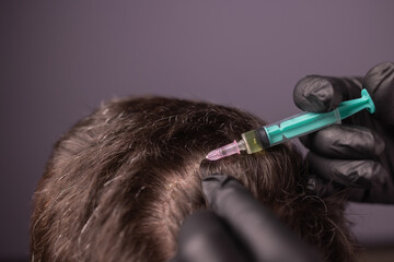 Mesotherapy for hair. Attractive man receiving injections in his head. Man having mesotherapy...