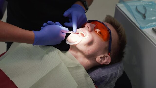 Orthodontist takes out arc from locks on patient's braces for replacement. His hands are gloved and he is holding an instrument. Mouth is wide open and mouth is fixed. Healthy and even teeth