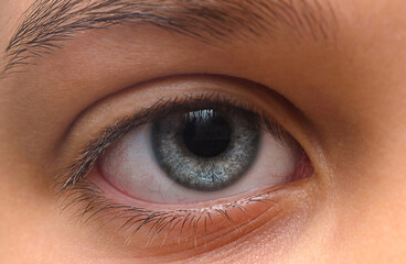 Child's eye macro