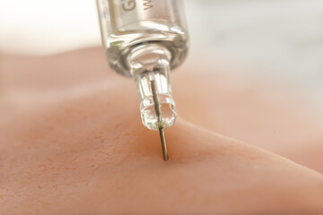 Close-up of an injection.  Administer medication with help of a syringe.