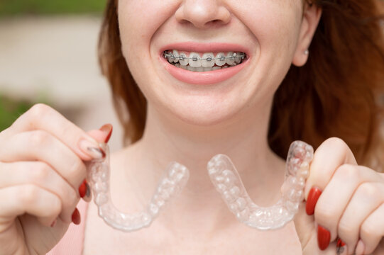 Beautiful young red-haired woman with braces on her teeth holding removable retainers outdoors