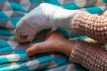 Child with bandage on leg heel fracture. Broken right foot, splint of toddler. Little boi sleeping on a blue blanket.