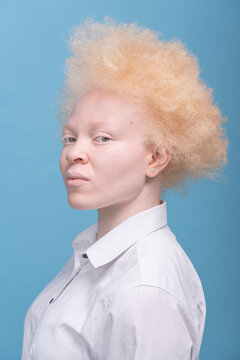 Studio portrait of albino woman in white shirt