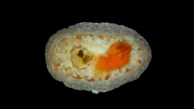 Pentacula Holothuroidea larva, Juvenile sea cucumber under microscope, type Echinodermata, a very unusual organism, at this stage, she sank to bottom and crawled in search of food. Barents Sea
