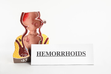 Anatomical model of rectum with card Hemorrhoids isolated on white