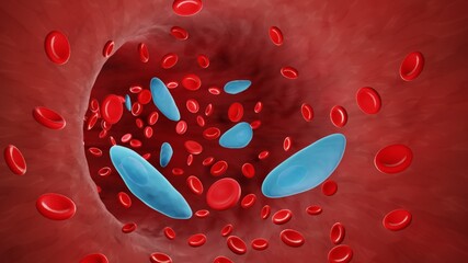 Toxoplasma in bloodstrem, Parasitic bloodstream infection