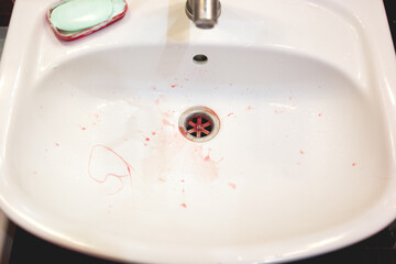 White wash basin, floss residues, blood stains from flosser damage to the gums.