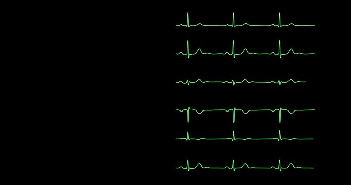 herzfrequenz hirnwellen ekg eeg herzschlag   elektroenzephalografie cardiogram oscilloscope close-up health monitoring 4k  