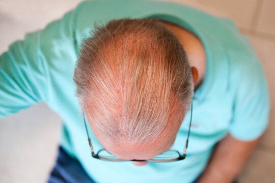 &Auml;lterer Mann mit lichtem Haar