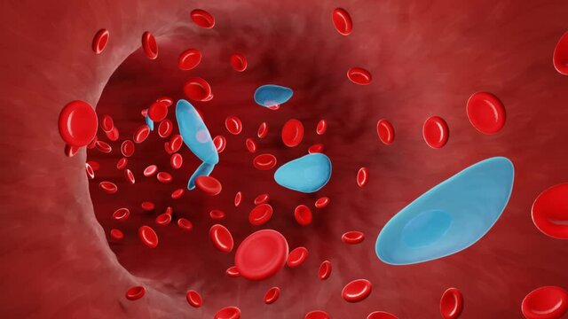 Toxoplasma in bloodstram, Parasitic blood infection