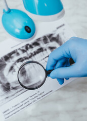 A doctor in protective medical gloves holds an X-ray picture of teeth in her hands and examines it through a magnifying glass