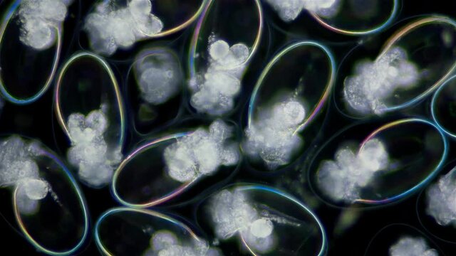 Eggs with Mollusca Nudibranchia embryos under a microscope, possibly Superfamily Fionoidea. They are attached to algae. Next stage, veliger, will float in water column. Barents Sea