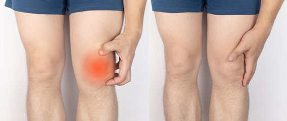 Before and after. On the left, a man is holding onto an injured knee, and on the right, doctors have already cured a patient. Ruptured knee tendons, muscles, meniscus injury, bone fracture or fissure - obrazy, fototapety, plakaty