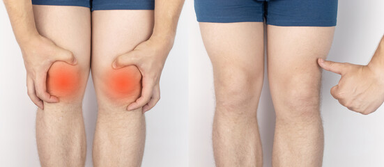 Before and after. On the left, a man is holding onto an injured knee, and on the right, doctors...