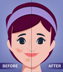 The young female face. Acne and clean skin. the portrait of beautiful woman surgery clinic.