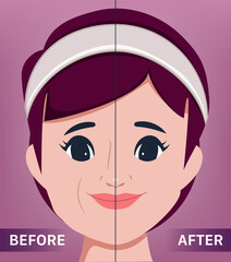 The young female face. Lifting and anti-aging. the portrait of beautiful woman surgery clinic.