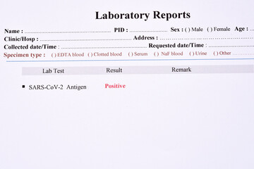 COVID-19 positive test result by using COVID-19 antigen test kit, rapid test method 