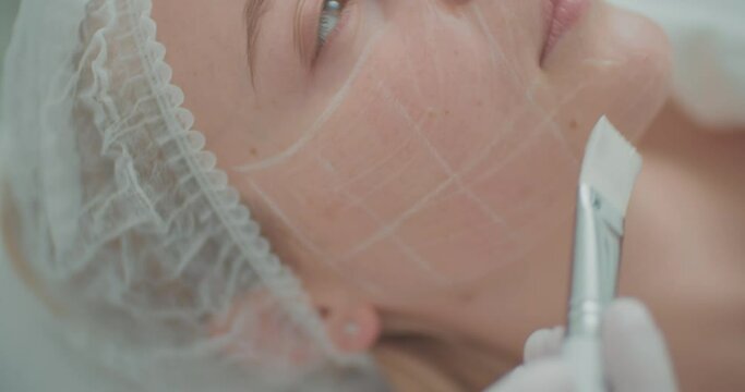 Close-up female cheek painted in white squares and cosmetologist is applying cream onto her cheek by using a cosmetic brush. Lifting procedure.